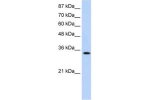 Western Blotting (WB) image for anti-Muscleblind-like Protein 1 (MBNL1) antibody (ABIN2462371) (MBNL1 Antikörper)