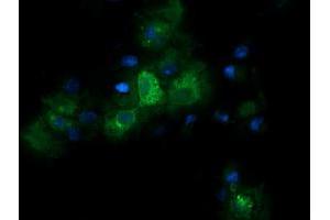 Image no. 3 for anti-Retinoic Acid Receptor Responder (Tazarotene Induced) 1 (RARRES1) antibody (ABIN1500602)