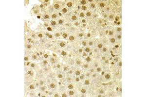Immunohistochemistry of paraffin-embedded human liver injury using SFN Antibody. (14-3-3 sigma/SFN Antikörper  (AA 1-248))