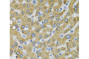 Immunohistochemistry of paraffin-embedded Human liver damage using SDC4 Polyclonal Antibody at dilution of 1:100 (40x lens). (SDC4 Antikörper)