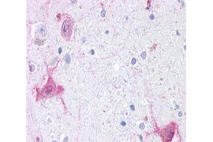 Anti-GPR6 antibody  ABIN1048844 IHC staining of human brain, neurons and glia. (GPR6 Antikörper  (Cytoplasmic Domain))