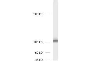 dilution: 1 : 1000; sample: rat hippocampus homogenate (GRIA2 Antikörper  (AA 278-292))