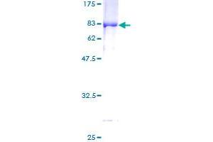Image no. 1 for Peroxisome Proliferator-Activated Receptor gamma (PPARG) (AA 1-477) protein (GST tag) (ABIN1315835)