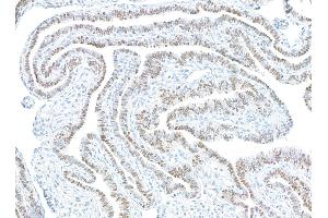 Immunohistochemistry (IHC) image for anti-Paired Box 8 (PAX8) antibody (ABIN7795602) (PAX8 Antikörper)