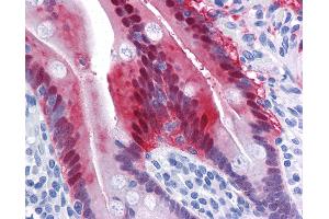Immunohistochemistry (IHC) image for anti-Aldo-Keto Reductase Family 1, Member B10 (Aldose Reductase) (AKR1B10) (AA 76-144) antibody (ABIN574456)