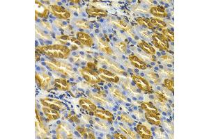 Immunohistochemistry of paraffin-embedded rat kidney using TCP1 antibody at dilution of 1:100 (x400 lens).