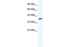 KCNK3 antibody used at 1. (KCNK3 Antikörper  (C-Term))