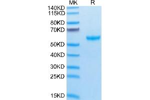 Cynomolgus APRIL Trimer on Tris-Bis PAGE under reduced condition. (TNFSF13 Protein (Trimer) (His-Avi-DYKDDDDK Tag))