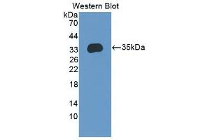 Western Blot; Sample: Recombinant protein. (ENPP2 Antikörper  (AA 637-905))