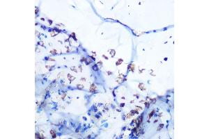 Immunohistochemistry of paraffin-embedded mouse bone marrow using ALDOA Rabbit mAb (ABIN7265550) at dilution of 1:100 (40x lens). (ALDOA Antikörper)