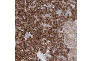 Immunohistochemical staining of human pancreas with UFL1 polyclonal antibody  shows strong cytoplasmic positivity in exocrine glandular cells at 1:50-1:200 dilution.