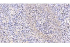 Detection of S100Z in Human Spleen Tissue using Polyclonal Antibody to S100 Calcium Binding Protein Z (S100Z) (S100Z Antikörper  (AA 1-99))