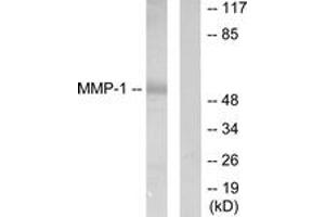 Western Blotting (WB) image for anti-Matrix Metallopeptidase 1 (Interstitial Collagenase) (MMP1) (AA 411-460) antibody (ABIN2889225) (MMP1 Antikörper  (AA 411-460))