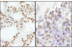 anti-Polymerase (DNA Directed), epsilon 3 (p17 Subunit) (POLE3) (AA 97-147) antibody