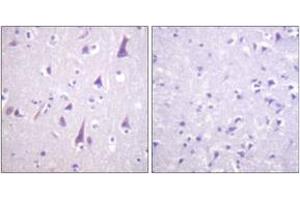 Immunohistochemistry analysis of paraffin-embedded human brain, using GFAP (Phospho-Ser38) Antibody. (GFAP Antikörper  (pSer38))