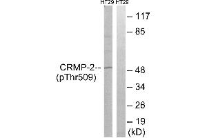 Immunohistochemistry analysis of paraffin-embedded human brain tissue using CRMP-2 (Phospho-Thr509) antibody. (DPYSL2 Antikörper  (pThr509))