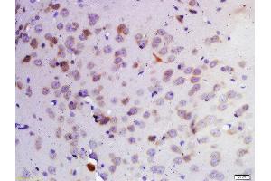 Formalin-fixed and paraffin embedded rat brain labeled with Rabbit Anti-KDM1 Polyclonal Antibody, Unconjugated 1:200 followed by conjugation to the secondary antibody and DAB staining (LSD1 Antikörper  (AA 101-200))