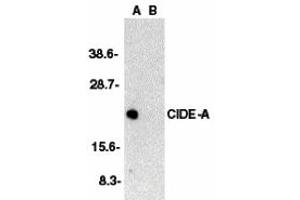 Western Blotting (WB) image for anti-Cell Death-Inducing DFFA-Like Effector A (CIDEA) (C-Term) antibody (ABIN1030333) (CIDEA Antikörper  (C-Term))
