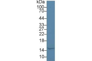 Western Blot; Sample: Bovine Milk; Primary Ab: 5µg/ml Rabbit Anti-Human aLA Antibody Second Ab: 0. (LALBA Antikörper  (AA 12-142))