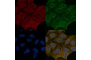 DIAPH1 Mouse Monoclonal Antibody staining Hela cells by IF/ICC. (DIAPH1 Antikörper  (N-Term))