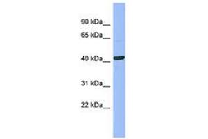 Image no. 1 for anti-serpin Peptidase Inhibitor, Clade B (Ovalbumin), Member 13 (SERPINB13) (AA 107-156) antibody (ABIN6741692) (SERPINB13 Antikörper  (AA 107-156))