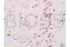 Formalin-fixed and paraffin embedded mouse brain labeled with Rabbit Anti Neurocan Polyclonal Antibody, Unconjugated (ABIN737001) at 1:200 followed by conjugation to the secondary antibody and DAB staining (Neurocan Antikörper  (AA 1185-1257))