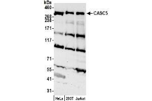 anti-Cancer Susceptibility Candidate 5 (CASC5) (AA 300-350) antibody