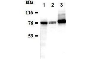 Western Blotting (WB) image for anti-Sodium Potassium ATPase, alpha1 (ATP1A1) antibody (ABIN1449189) (ATP1A1 Antikörper)