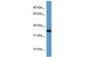 WB Suggested Anti-NQO1 AntibodyTitration: 1. (NQO1 Antikörper  (C-Term))