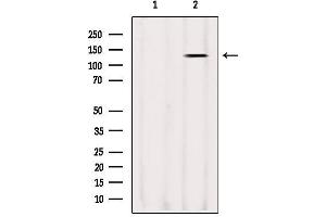 Western blot analysis of extracts from Sp2/0, using LRPPRC Antibody. (LRPPRC Antikörper  (Internal Region))