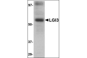 Western blot analysis of LGI3 in human brain tissue lysate with this product at 1 μg/ml.