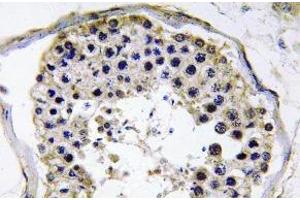 Immunohistochemistry (IHC) analyzes of TRAF6 antibody in paraffin-embedded human testis tissue. (TRAF6 Antikörper)