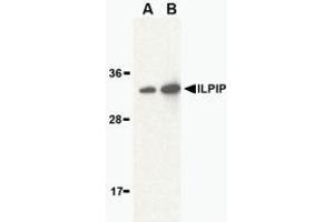 Western blot analysis of ILPIP in human brain lysate with AP30431PU-N ILPIP antibody at (A) 1 and (B) 2 μg/ml. (STRADB Antikörper  (Intermediate Domain))