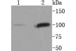Western Blotting (WB) image for anti-Signal Transducer and Activator of Transcription 6, Interleukin-4 Induced (STAT6) antibody (ABIN5557533)