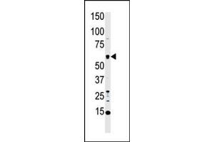 MST1 Antikörper  (C-Term)