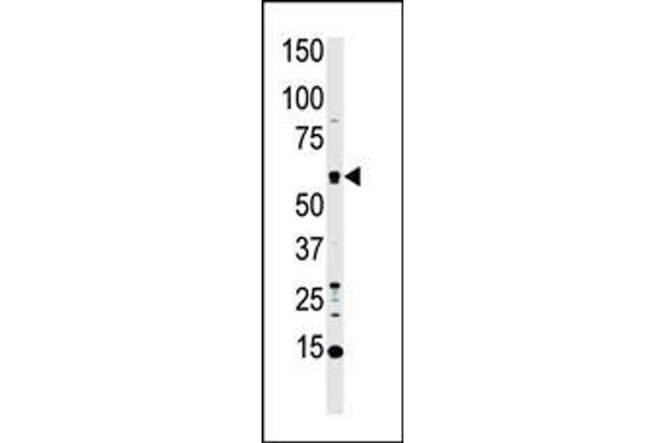 MST1 Antikörper  (C-Term)