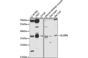 Western blot analysis of extracts of various cell lines, using IL10RB antibody (ABIN7267983) at 1:1000 dilution. (IL10RB Antikörper  (AA 20-220))