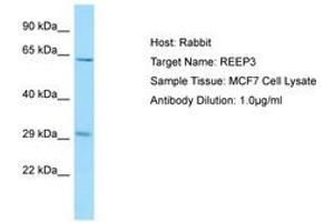 Image no. 1 for anti-Receptor Accessory Protein 3 (REEP3) (AA 154-203) antibody (ABIN6750069) (REEP3 Antikörper  (AA 154-203))