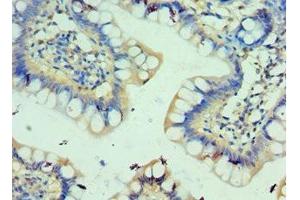 Immunohistochemistry of paraffin-embedded human small intestine tissue using ABIN7146163 at dilution of 1:100 (C3AR1 Antikörper  (AA 160-340))