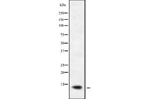 Western blot analysis of XCL1/2 using K562 whole cell lysates (XCL1/XCL2 Antikörper)