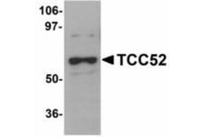 Image no. 1 for anti-DDB1 and CUL4 Associated Factor 12 (DCAF12) (C-Term) antibody (ABIN478276) (DCAF12 Antikörper  (C-Term))