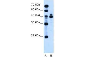Image no. 2 for anti-Indian Hedgehog (IHH) (AA 24-73) antibody (ABIN205075) (Indian Hedgehog Antikörper  (AA 24-73))