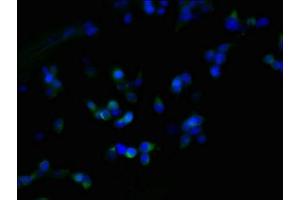 Immunofluorescent analysis of 293T cells using ABIN7162546 at dilution of 1:100 and Alexa Fluor 488-congugated AffiniPure Goat Anti-Rabbit IgG(H+L) (ZDHHC23 Antikörper  (AA 187-302))