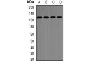 Western blot analysis of Hexokinase 2 expression in SHSY5Y (A), MCF7 (B), K562 (C), COS7 (D) whole cell lysates. (Hexokinase 2 Antikörper)