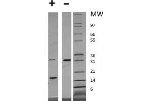SDS-PAGE (SDS) image for Platelet Derived Growth Factor A (PDGFA) protein (ABIN6700381)