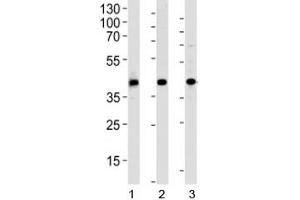 Western blot analysis of 1) human HepG2, 2) mouse kidney and 3) rat spleen tissue lysate using ACADL antibody at 1:1000. (ACADL Antikörper  (AA 14-43))