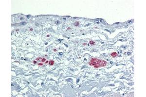 SOX7 antibody was used for immunohistochemistry at a concentration of 4-8 ug/ml. (SOX7 Antikörper  (Middle Region))