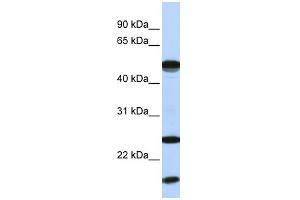 WB Suggested Anti-UBE2L6 Antibody Titration:  0.