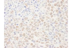 Immunohistochemistry (IHC) image for anti-N-Acetyltransferase 10 (GCN5-Related) (NAT10) (AA 650-700) antibody (ABIN7455028) (NAT10 Antikörper  (AA 650-700))