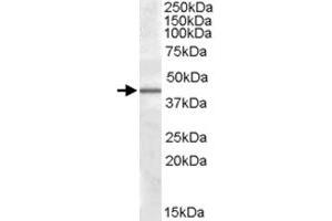 CAMK1D polyclonal antibody  (0. (CAMK1D Antikörper)
